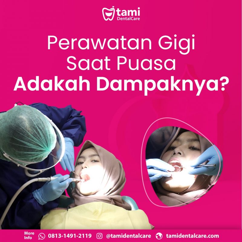 Perawatan Gigi Saat Puasa Adakah Dampaknya Tami Dental Care Klinik Dokter Gigi Bandung 